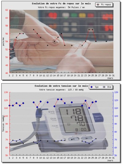 Graphes du suivi de sant�